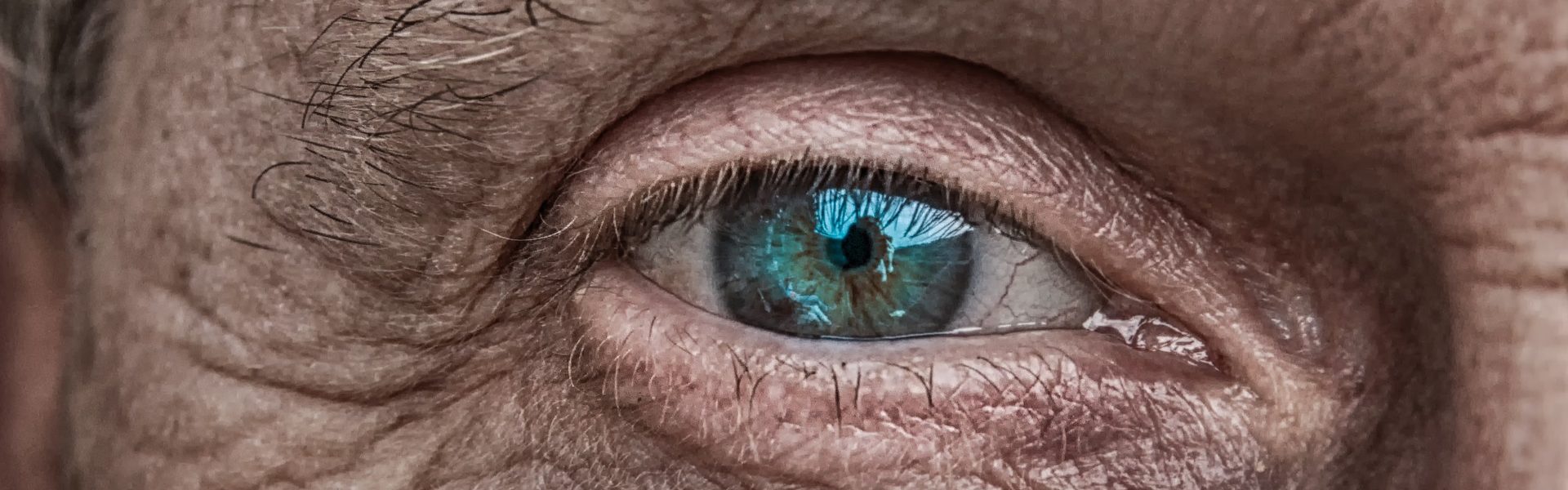 Benefits of Cataract Surgery banner