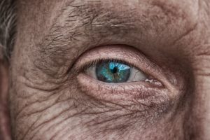 Benefits of Cataract Surgery featured image