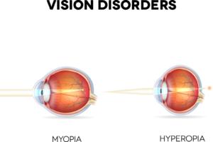 What Eye Conditions Does LASIK Treat? featured image