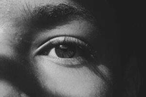 The Truth About Dry Eyes and LASIK: Who Should Be Cautious featured image