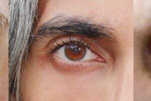 What Happens to Your Eyes as You Age, Even After LASIK? featured image