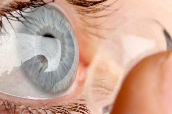 Can Wearing Contacts Long-Term Lower Your Chances of Qualifying for LASIK? featured image